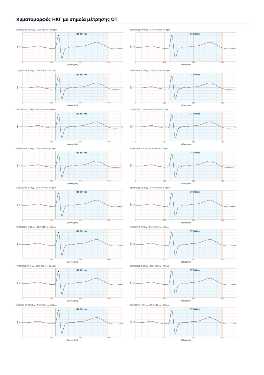 Δείγμα ιατρικής αναφοράς του QTc Tracker, σελίδα 2