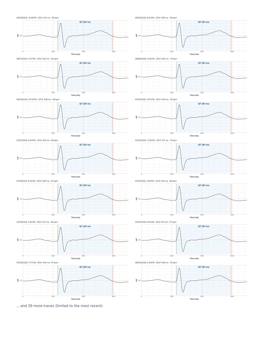Sample QT Tracker doctor report, page 3