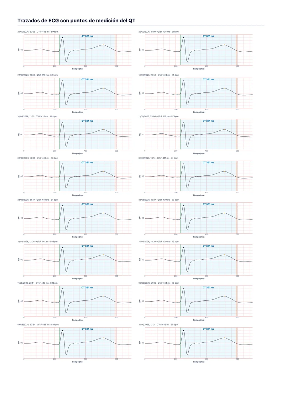 Informe médico de ejemplo de QTc Tracker, página 2