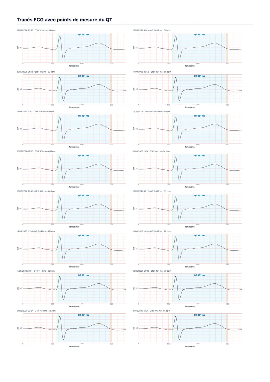 Exemple de rapport médical QTc Tracker, page 2