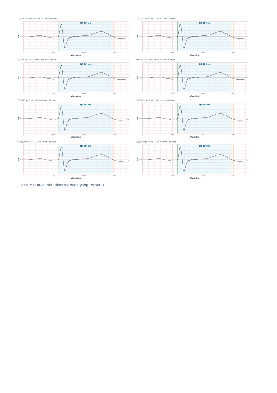 Contoh laporan dokter QTc Tracker, halaman 3