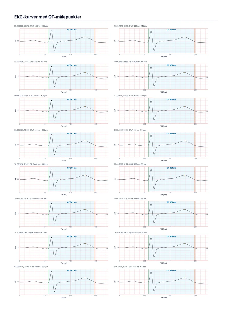 Eksempel på legerapport fra QTc Tracker, side 2