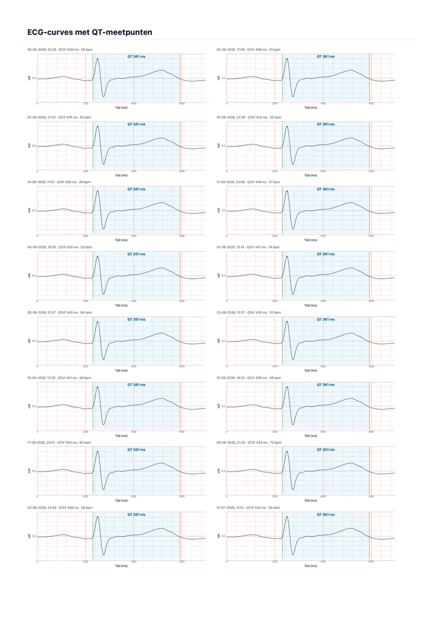 Voorbeeld-artsrapport van QTc Tracker, pagina 2