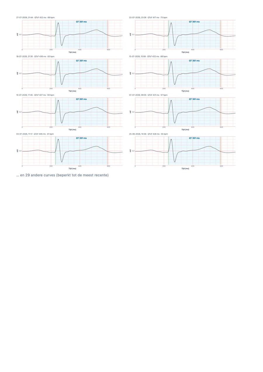 Voorbeeld-artsrapport van QTc Tracker, pagina 3