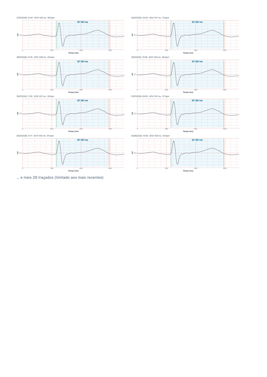 Relatório médico de exemplo do QTc Tracker, página 3