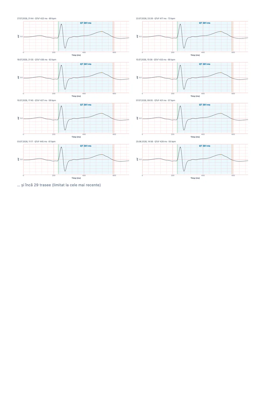 Raport exemplu pentru medic din QTc Tracker, pagina 3