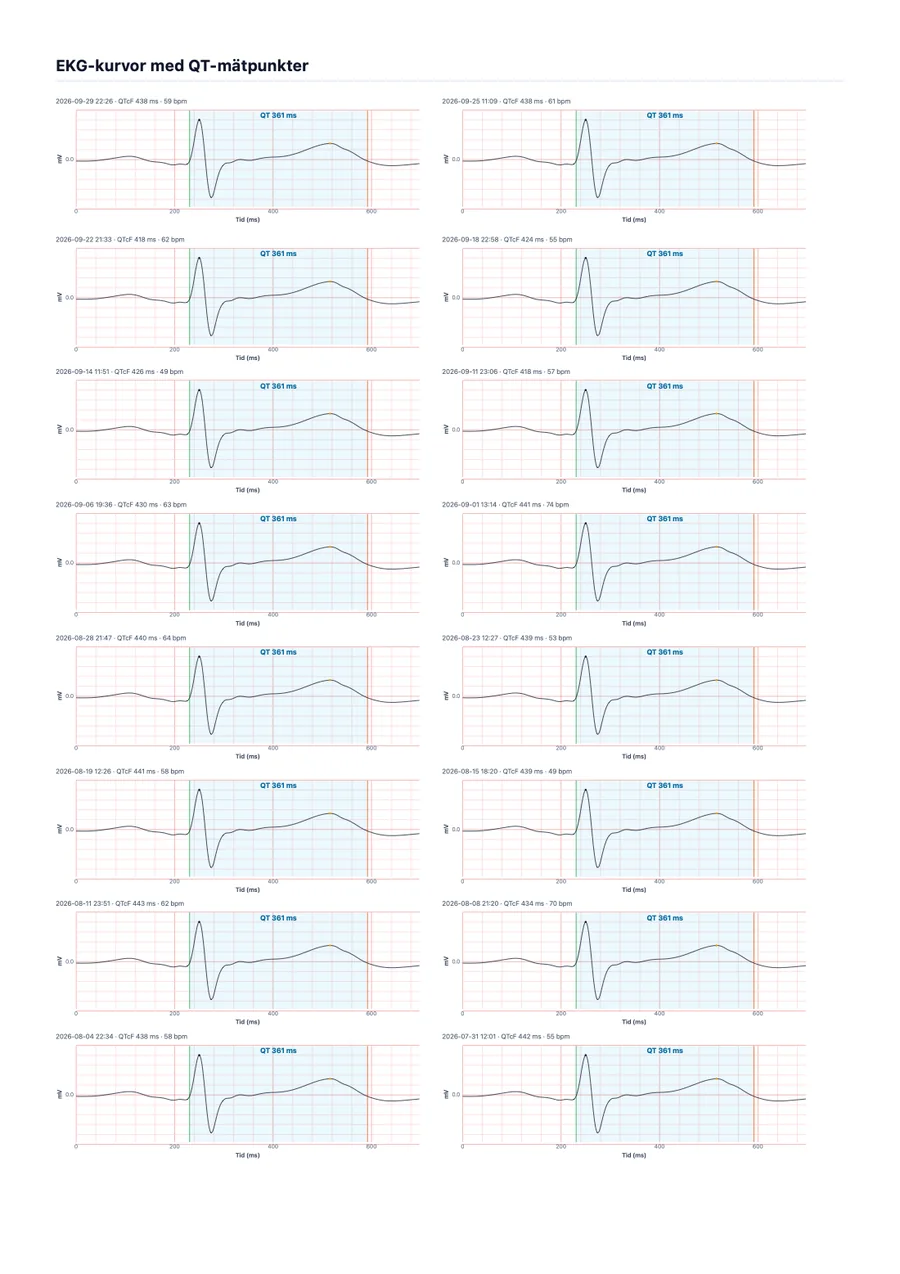 Exempel på läkarrapport från QTc Tracker, sida 2