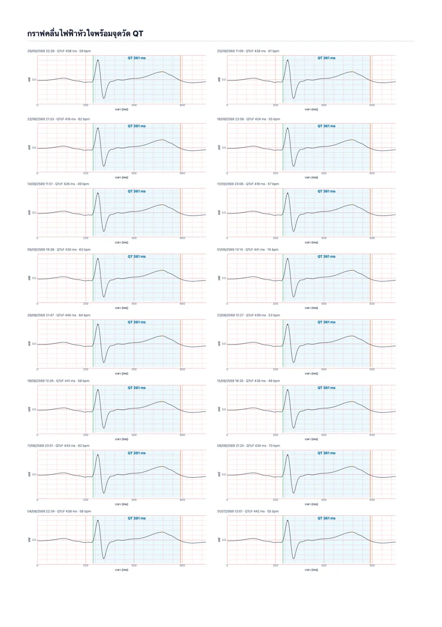 ตัวอย่างรายงานสำหรับแพทย์ของ QTc Tracker หน้า 2