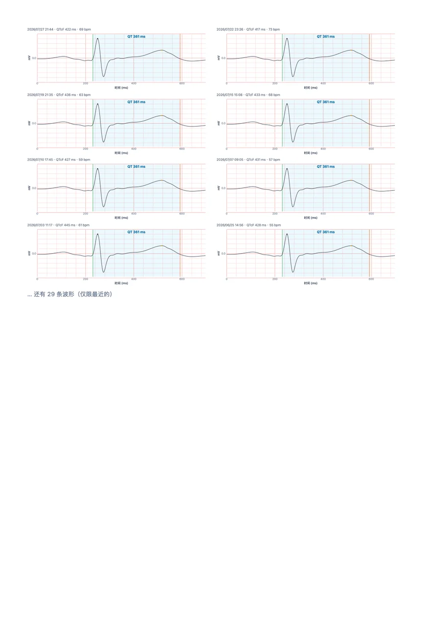 QTc Tracker 医生报告示例，第 3 页