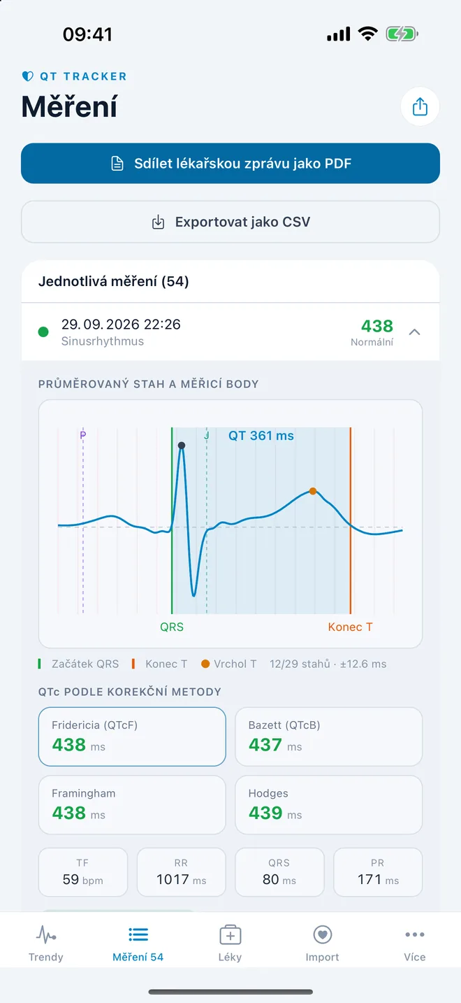 QTc Tracker: průměrovaný stah EKG s měřicími body QT