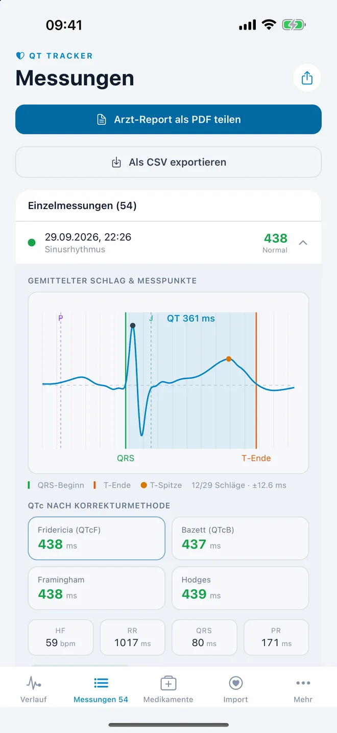 QTc Tracker: gemittelter EKG-Schlag mit QT-Messpunkten