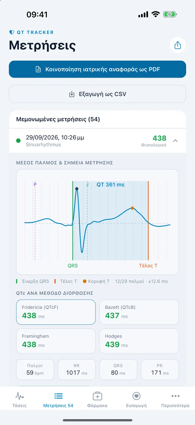 QTc Tracker: μέσος παλμός ΗΚΓ με σημεία μέτρησης QT