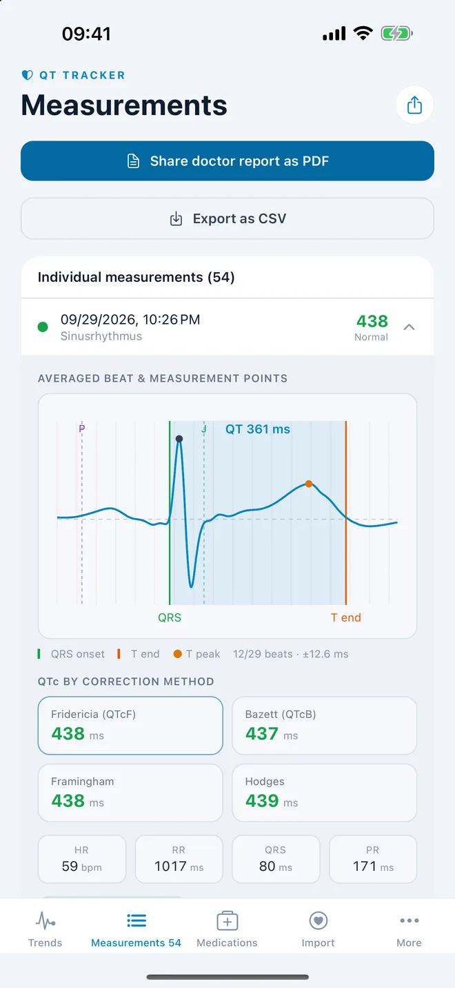 QT Tracker: averaged ECG beat with QT measuring points