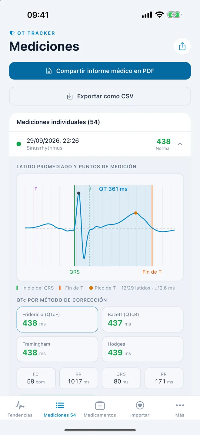 QTc Tracker: latido de ECG promediado con puntos de medición del QT