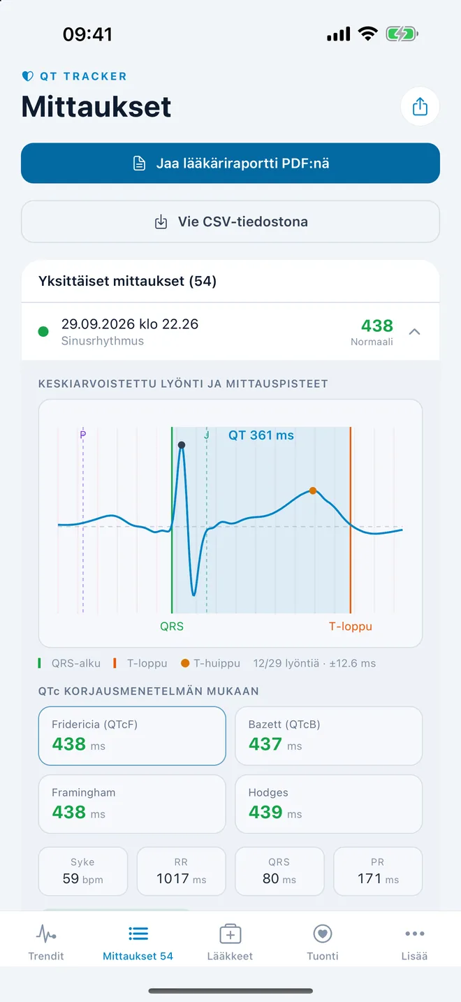 QTc Tracker: keskiarvoistettu EKG-lyönti ja QT-mittauspisteet