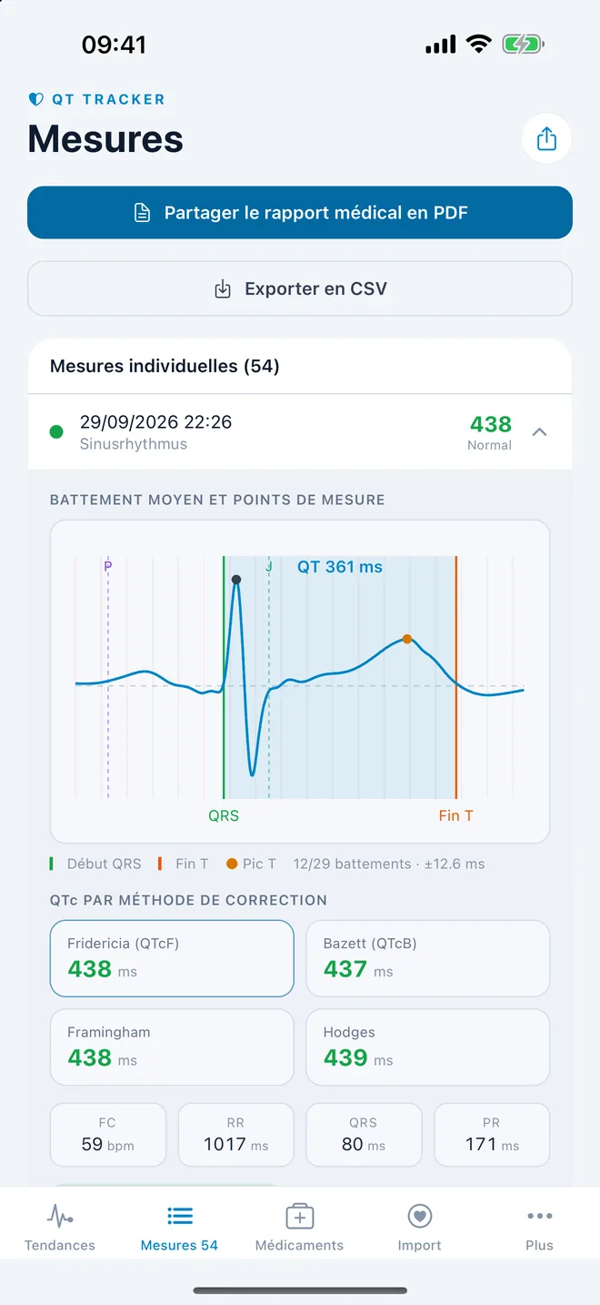 QTc Tracker : battement ECG moyen avec points de mesure du QT