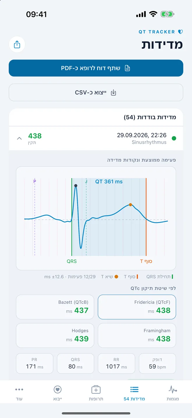 QTc Tracker: פעימת אק״ג ממוצעת עם נקודות מדידת QT