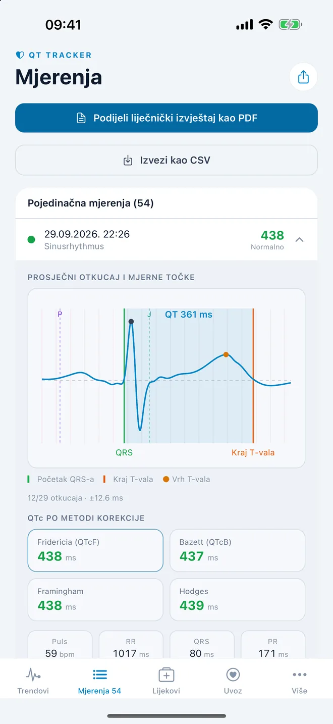 QTc Tracker: prosječni EKG otkucaj s mjernim točkama QT-a
