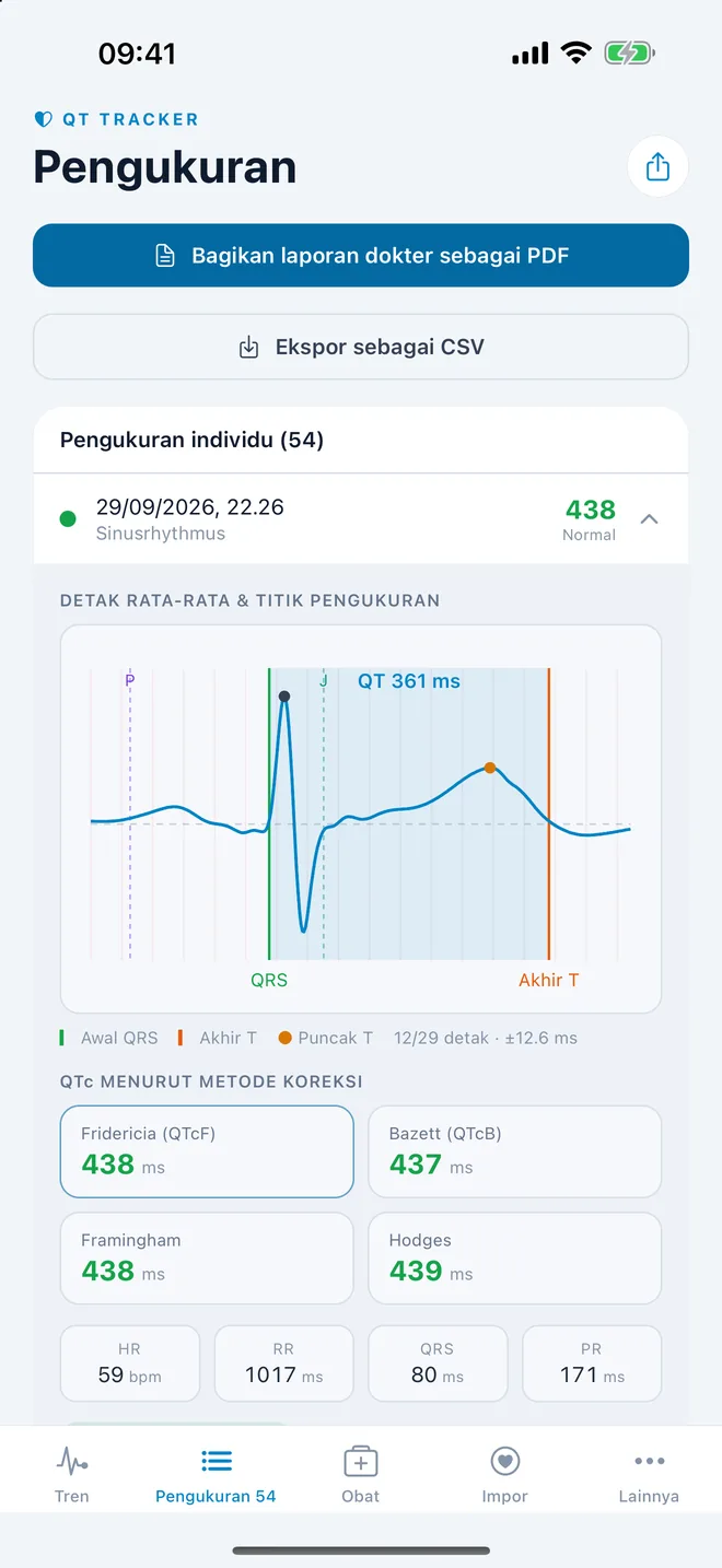 QTc Tracker: detak EKG rata-rata dengan titik pengukuran QT