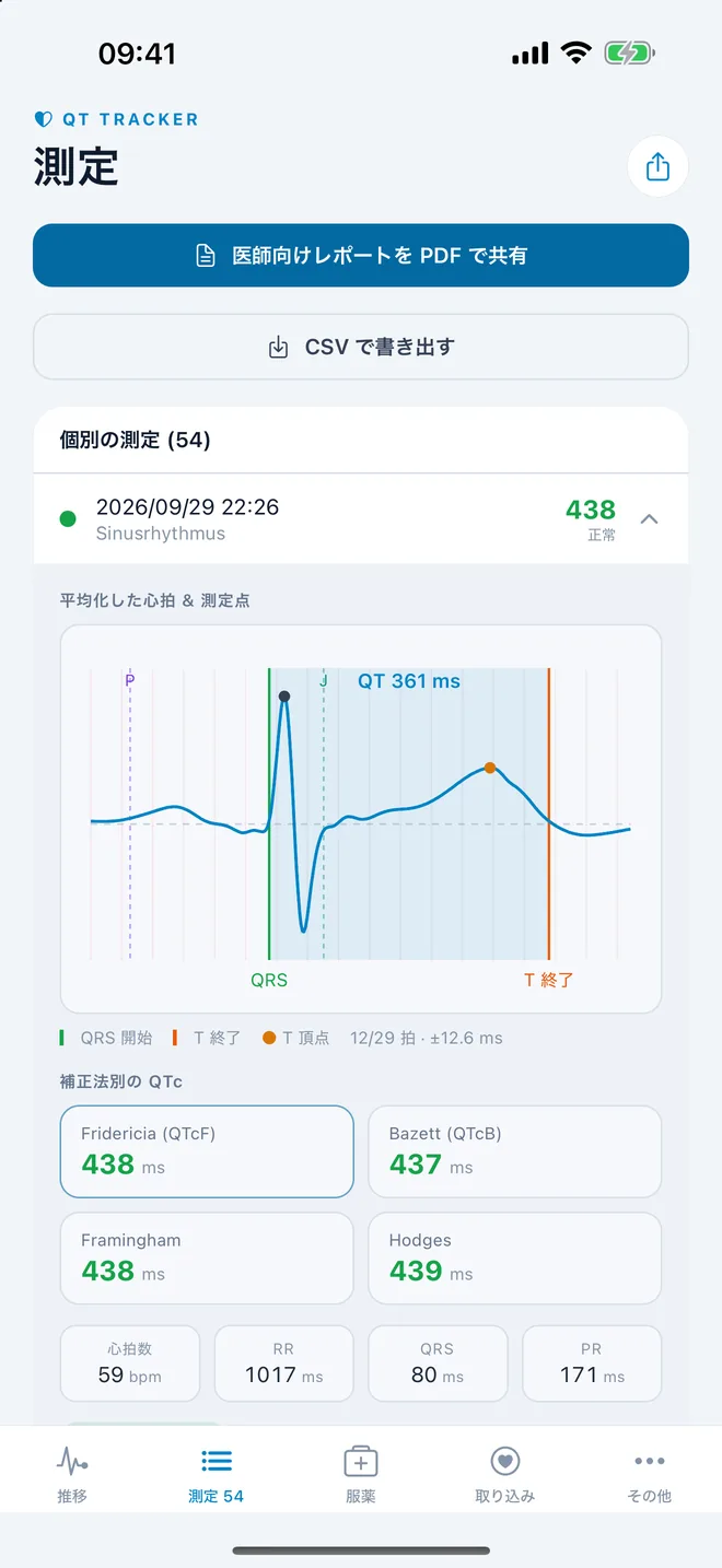 QTc Tracker：QT 測定点付きの平均化した心電図の拍動