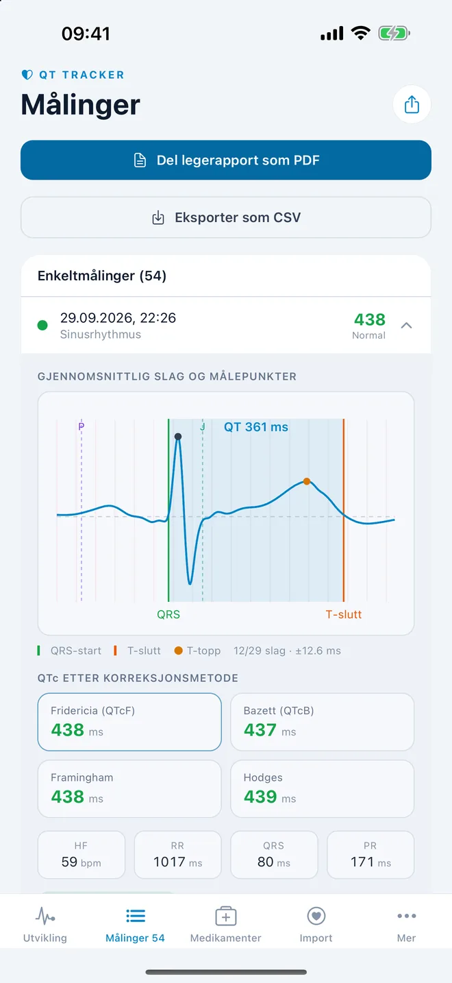 QTc Tracker: gjennomsnittlig EKG-slag med QT-målepunkter