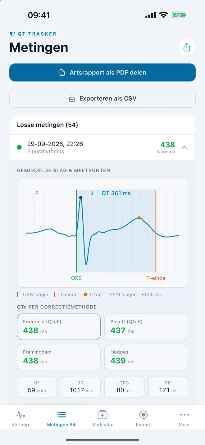 QTc Tracker: gemiddelde ECG-slag met QT-meetpunten