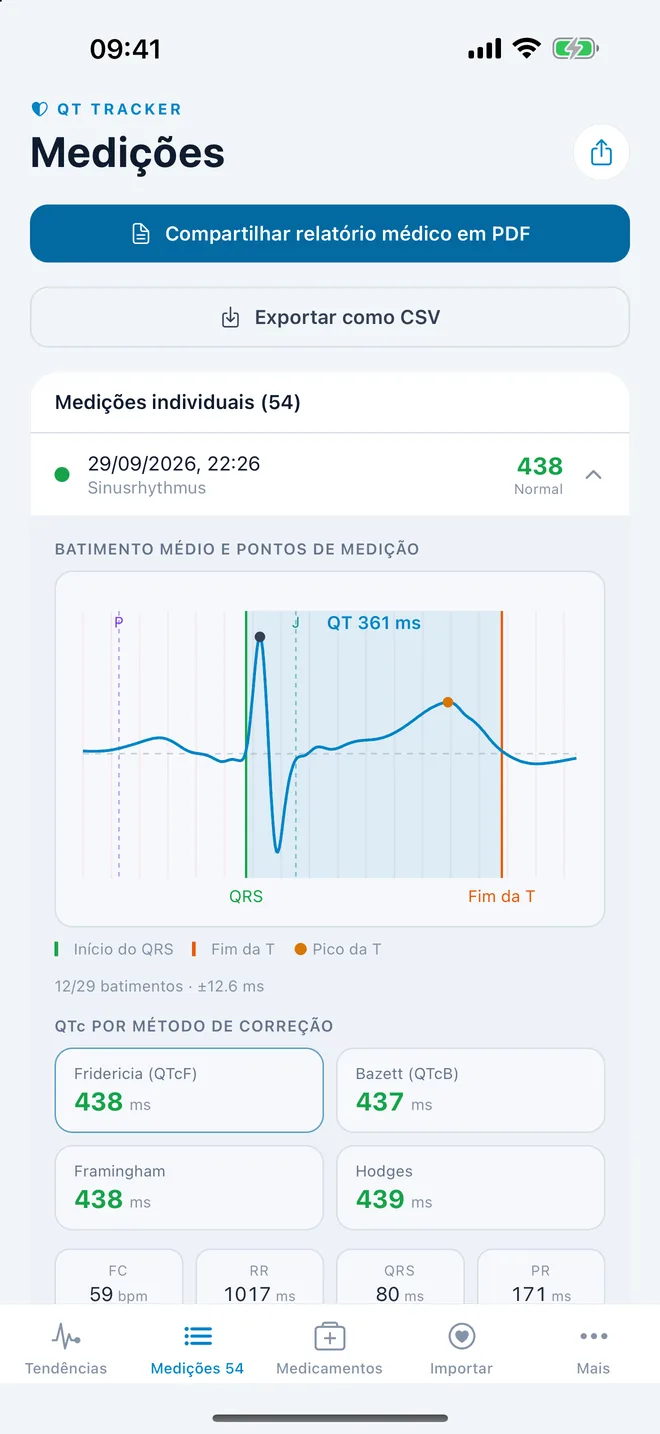 QTc Tracker: batimento médio do ECG com pontos de medição do QT