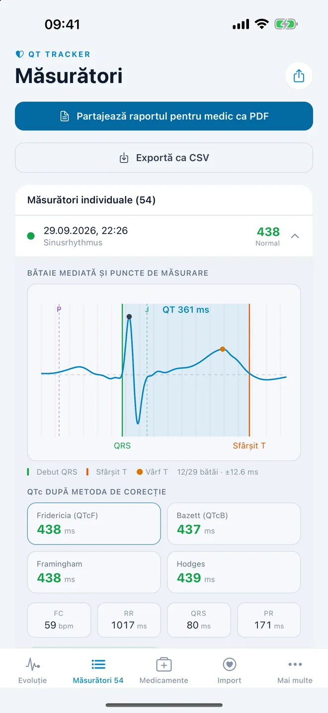 QTc Tracker: bătaie ECG mediată cu punctele de măsurare QT