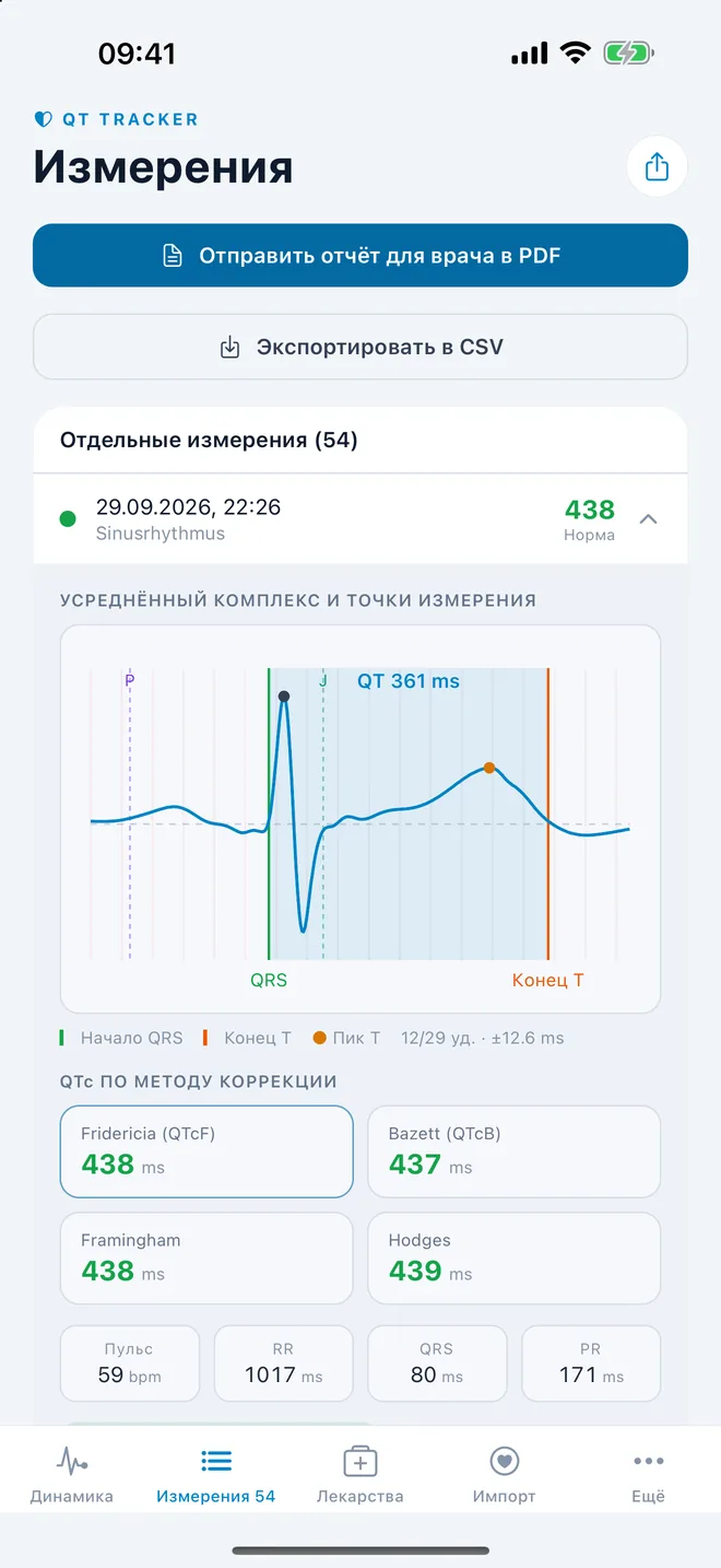 QTc Tracker: усреднённый комплекс ЭКГ с точками измерения QT