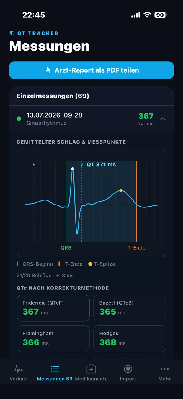 SSRI QT Tracker: averaged ECG beat with QT/QTc measurement points