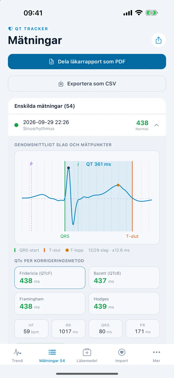 QTc Tracker: genomsnittligt EKG-slag med QT-mätpunkter