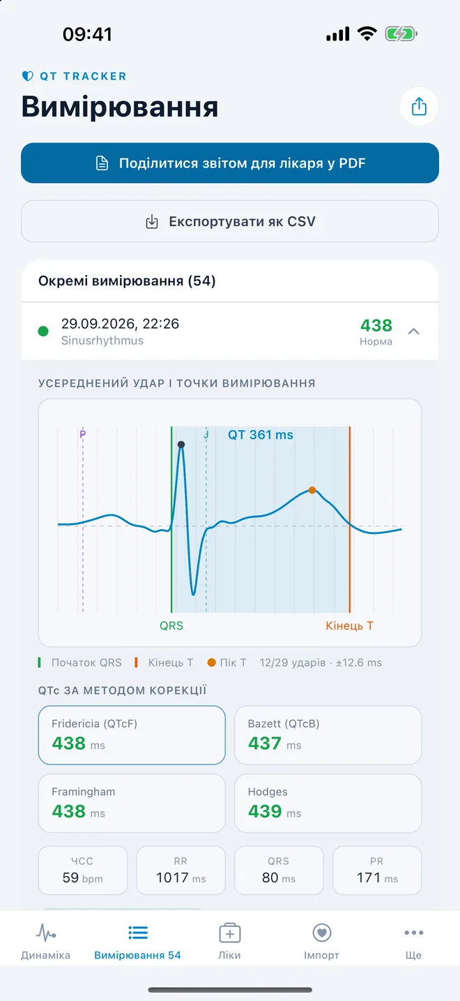 QTc Tracker: усереднений удар ЕКГ з точками вимірювання QT