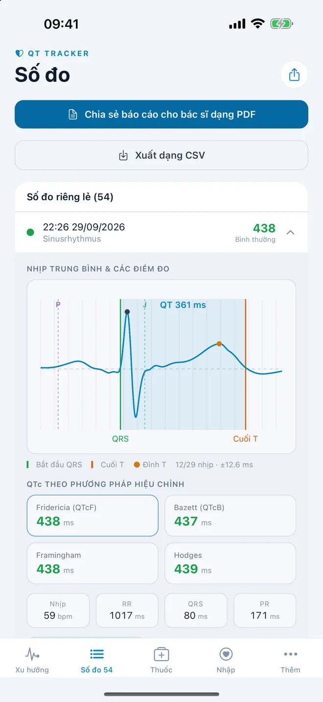 QTc Tracker: nhịp ECG trung bình với các điểm đo QT