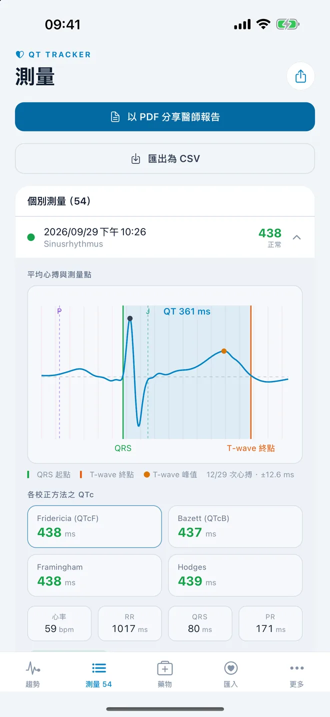 QTc Tracker：標示 QT 測量點的平均心電圖心搏